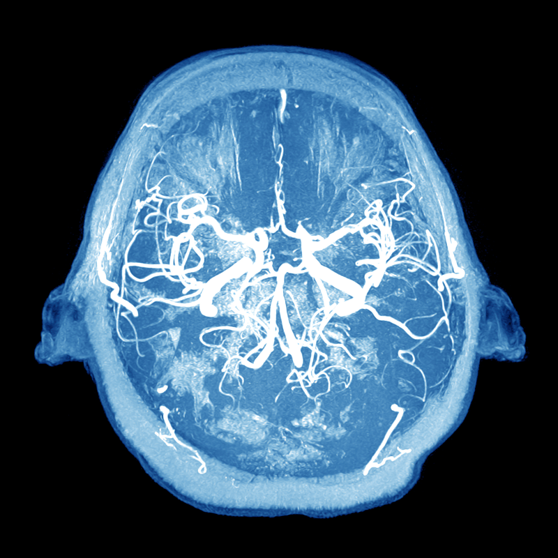 brain